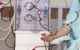 حذف لبنیات چه بلایی سر بیماران کلیوی می آورد حذف لبنیات چه بلایی سر بیماران کلیوی می آورد